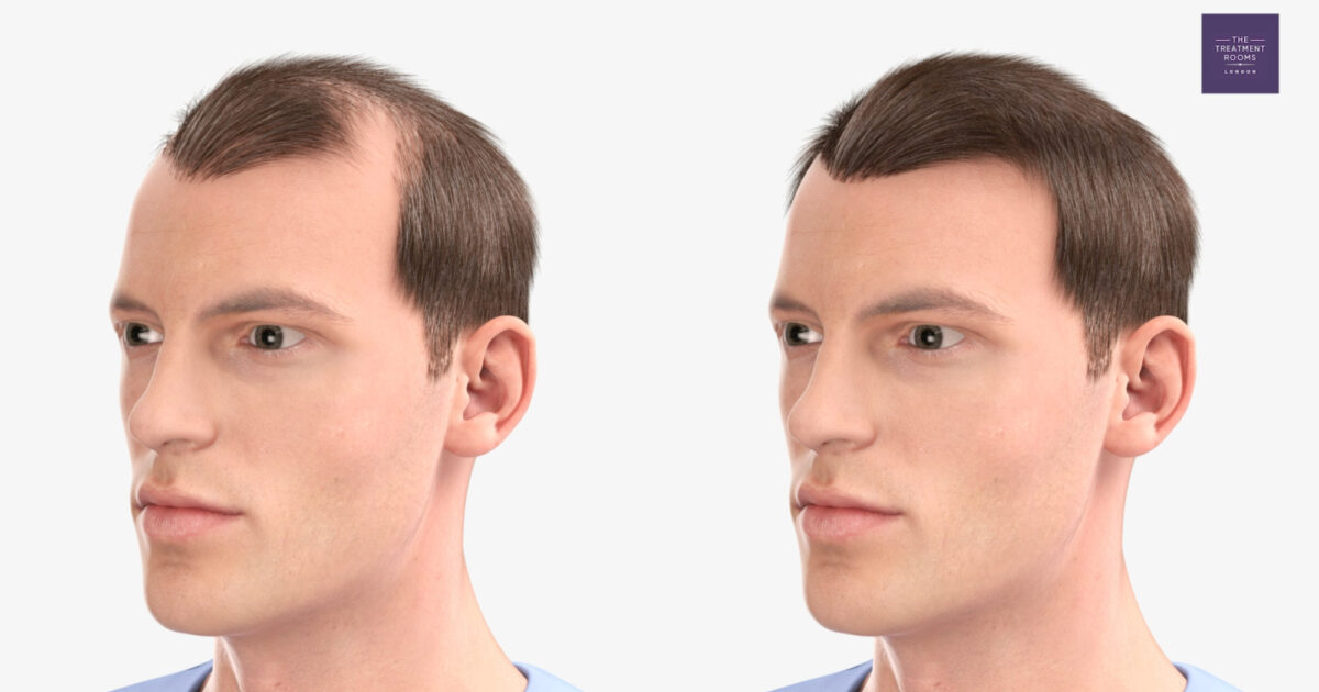 Healthcare video production Bristol Beeston Media